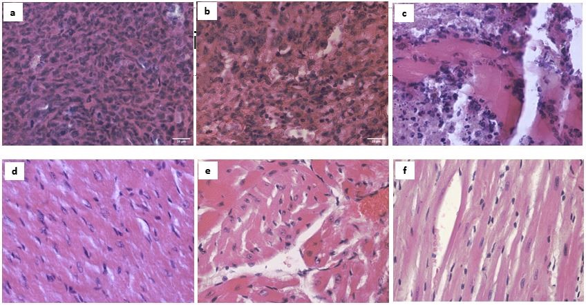 Histopathological impact of Redox-responsive methacrylamide based micellar nanoparticles on Orthotopic Models of Triple Negative Breast Cancers