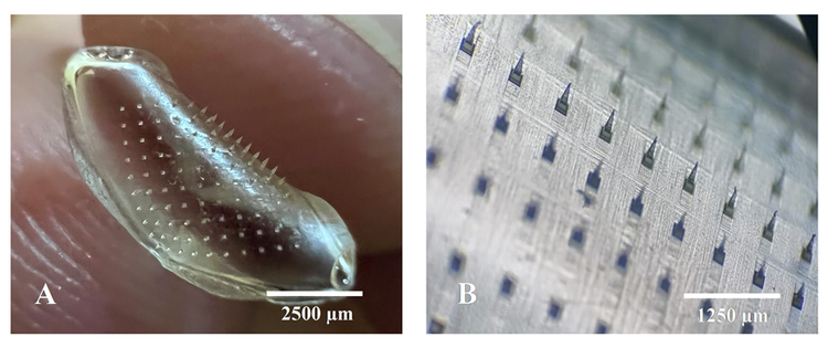 Dissolving Microneedle Patches as Vaccine Delivery Platforms